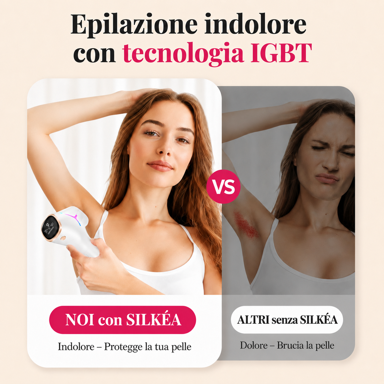 SILKÉA™ | Epilatore IPL Professionale per Uso Domestico