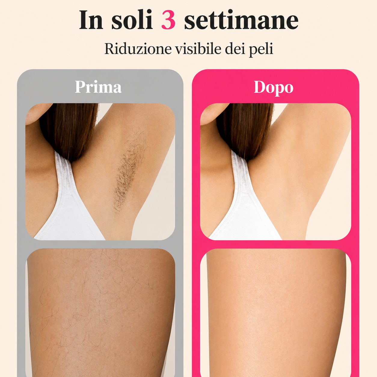 SILKÉA™ | Epilatore IPL Professionale per Uso Domestico